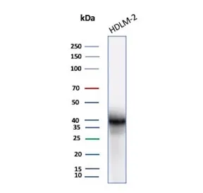 PD-L1 Recombinant Antibody / B7-H1 / CD274 - image 1