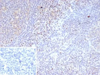 LEF1 Recombinant Antibody / Lymphoid enhancer-binding factor 1 / TCF1 alpha - image 1
