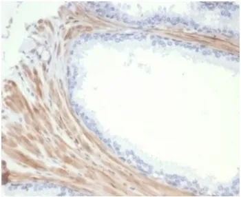 Aciculin Recombinant Antibody / Phosphoglucomutase 5 / PGM5 - image 1