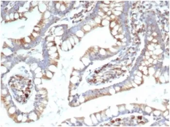 TREM2 Antibody - image 1