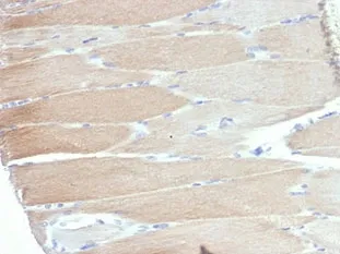 ACTN2 Recombinant Antibody / Alpha Actinin 2 / Sarcomeric Alpha Actinin - image 1
