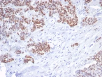 TP53 Recombinant Antibody / p53 - image 1