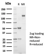 TSH beta Recombinant Antibody / TSHB - image 1