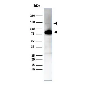 CAD Recombinant Antibody / CALD1 / Caldesmon - image 1