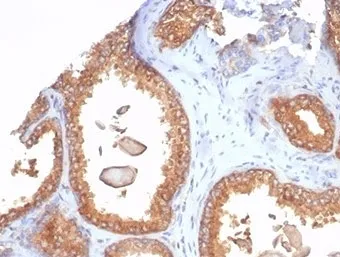 Beta-2 Microglobulin Recombinant Antibody - image 1