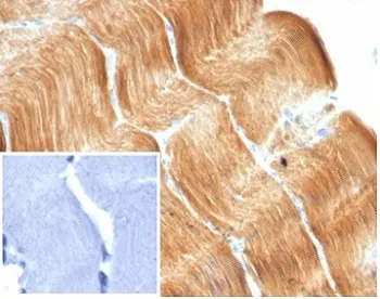 Alpha Actinin 2 Recombinant Antibody / ACTN2 / Sarcomeric Alpha Actinin - image 1