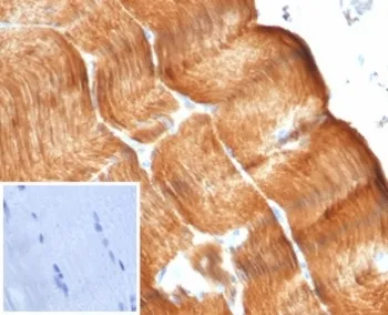 Sarcomeric Alpha Actinin Recombinant Antibody / Alpha Actinin 2 / ACTN2 - image 1