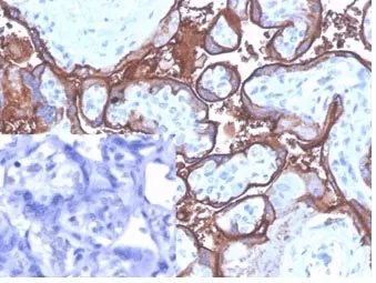 ALPP Antibody / Placental Alkaline Phosphatase - image 1