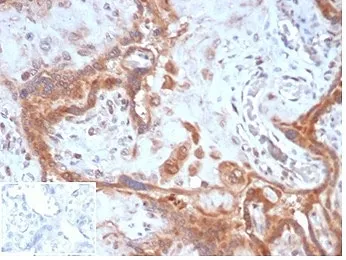 Fibroblast Activation Protein Alpha Antibody / FAP - image 1