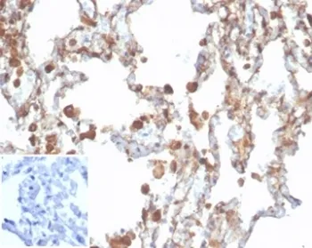 ALDH1A1 Recombinant Antibody / Aldehyde Dehydrogenase 1A1 - image 1