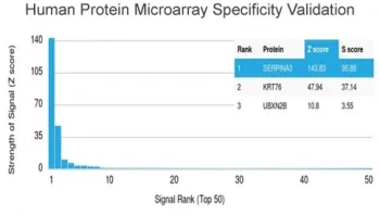 Alpha-1-Antichymotrypsin Antibody / AACT / SERPINA3 - image 1
