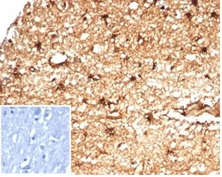 Aldehyde Dehydrogenase 1A1 Recombinant Antibody / ALDH1A1 - image 1