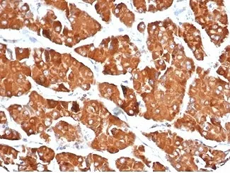 RHOBTB2 Antibody / DBC2 - image 1