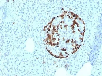 VDBP Antibody / Vitamin D binding protein / GC - image 1