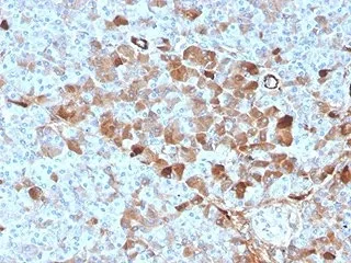 Vitamin D binding protein Antibody / VDBP / GC - image 1