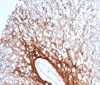 GFAP Antibody / Glial Fibrillary Acidic Protein - image 1