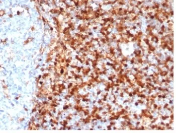 ANXA1 Recombinant Antibody / Annexin A1 - image 1
