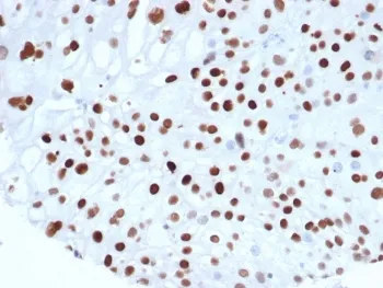 p21WAF1 Recombinant Antibody / CDKN1A - image 1