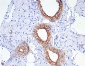 CFTR Recombinant Antibody / Cystic Fibrosis Transmembrane Regulator - image 1