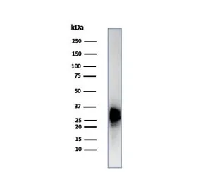 Calbindin 2 Recombinant Antibody / CALB2 / Calretinin - image 1