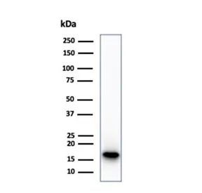 CDKN2A Recombinant Antibody / p16INK4a - image 1