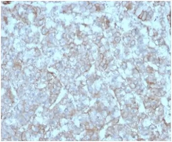 MCP2 Antibody / CCL8 - image 1
