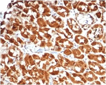 Interleukin 2 Recombinant Antibody - image 1
