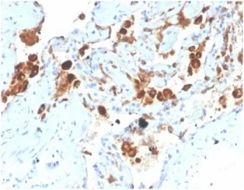 Surfactant protein D Antibody / SFTPD - image 1
