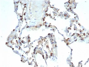 SFTPD Recombinant Antibody / Surfactant protein D - image 1