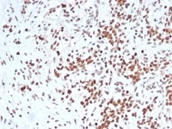 SMARCB1 Recombinant Antibody / Integrase interactor 1 / INI1 / BAF47 - image 1