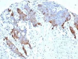 Transglutaminase 2 Recombinant Antibody (FN Binding Domain) - image 1