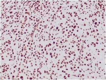 INI1 Antibody / Integrase interactor 1 / SMARCB1 / BAF47 - image 1