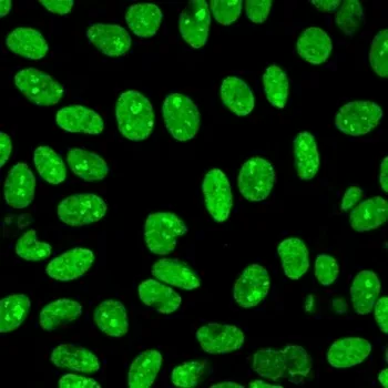 Human Nuclear Antigen Recombinant Antibody - image 1