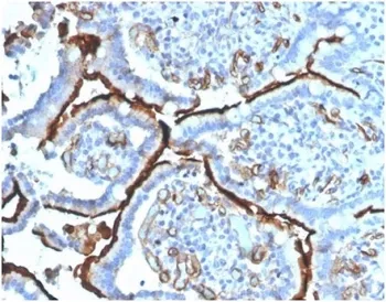 Angiotensin Converting Enzyme Antibody / ACE - image 1