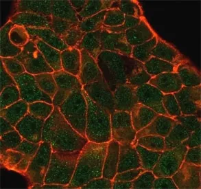 Decapping Protein 2 Antibody / DCP2 / m7GpppN-mRNA hydrolase - image 1