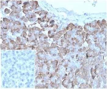 VLDLR Recombinant Antibody / VLDL Receptor - image 1