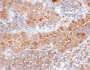 Calcitonin Antibody / CALCA / CGRP - image 1