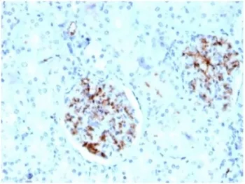 Fatty Acid Binding Protein 4 Antibody / FABP4 - image 1