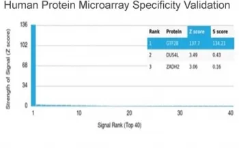 TFIIB Antibody / GTF2B - image 1