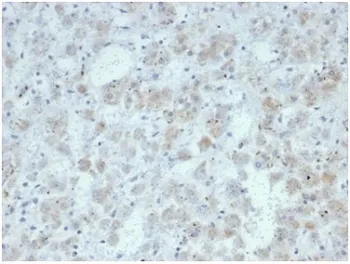 IL15 Recombinant Antibody / Interleukin 15 - image 1