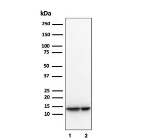 MIF Antibody / Macrophage Migration Inhibitory Factor - image 1