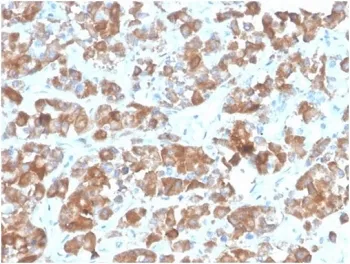 LH beta Recombinant Antibody / Luteinizing Hormone beta - image 1