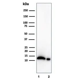 Macrophage Migration Inhibitory Factor Antibody / MIF - image 1