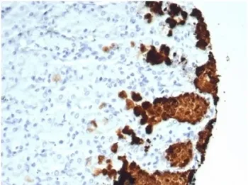 Gastric Mucin Recombinant Antibody / MUC5AC - image 1