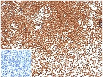 NPM1 Recombinant Antibody / Nucleophosmin - image 1