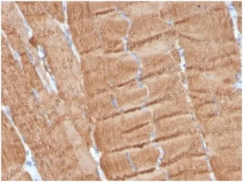 Actin alpha 1 Antibody / ACTA1 - image 1