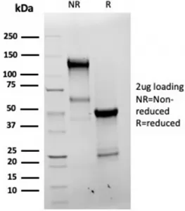 Bcl-X Recombinant Antibody / BCL2L1 - image 1