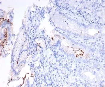 Helicobacter pylori Antibody (Catalase) - image 1