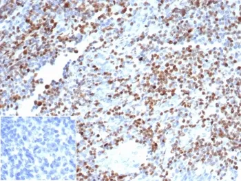 POU2F2 Recombinant Antibody / OCT2 - image 1