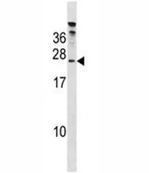 HIV Tat Specific Factor 1 Antibody (HTATSF1) - image 1